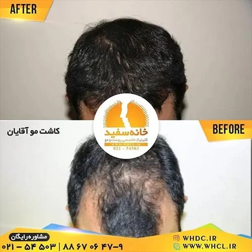 hair 1