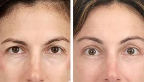 تغییرات متداول در زیبایی ابرو