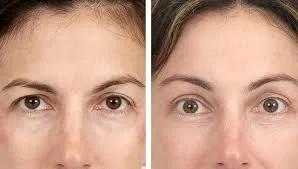 تغییرات متداول در زیبایی ابرو
